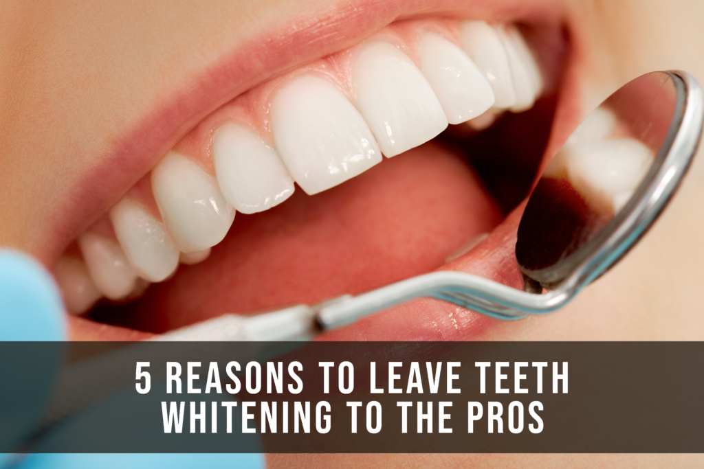 5 Reasons To Leave Teeth Whitening To The Pros